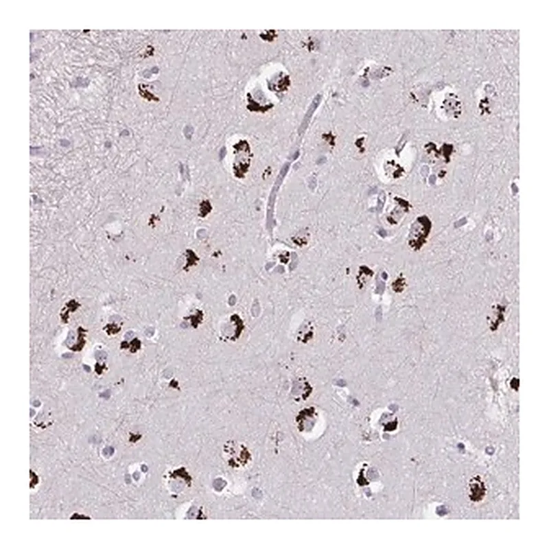 Merck Anti-GLTPD2 antibody produced in rabbit