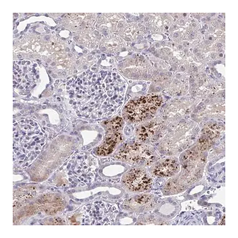 Merck Anti-PRPF38A antibody produced in rabbit