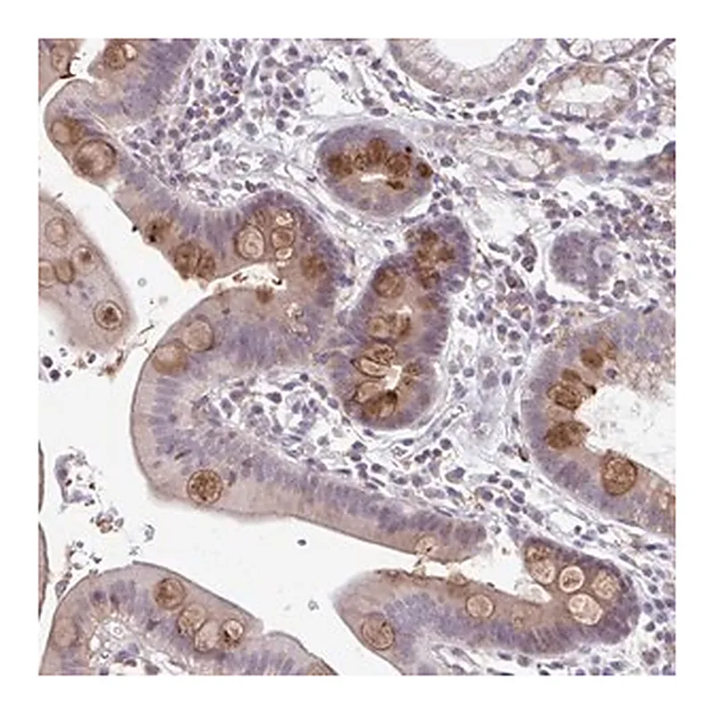 Merck Anti-ADAT3 antibody produced in rabbit