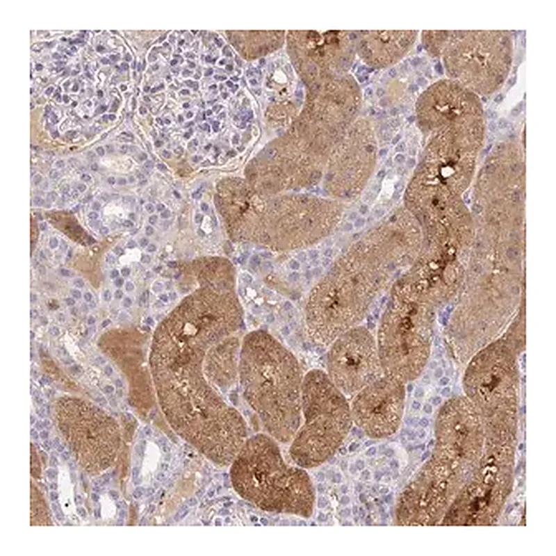 Merck Anti-ANO5 antibody produced in rabbit
