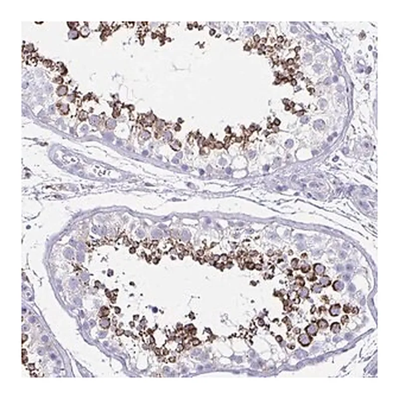 Merck Anti-HRASLS2 antibody produced in rabbit