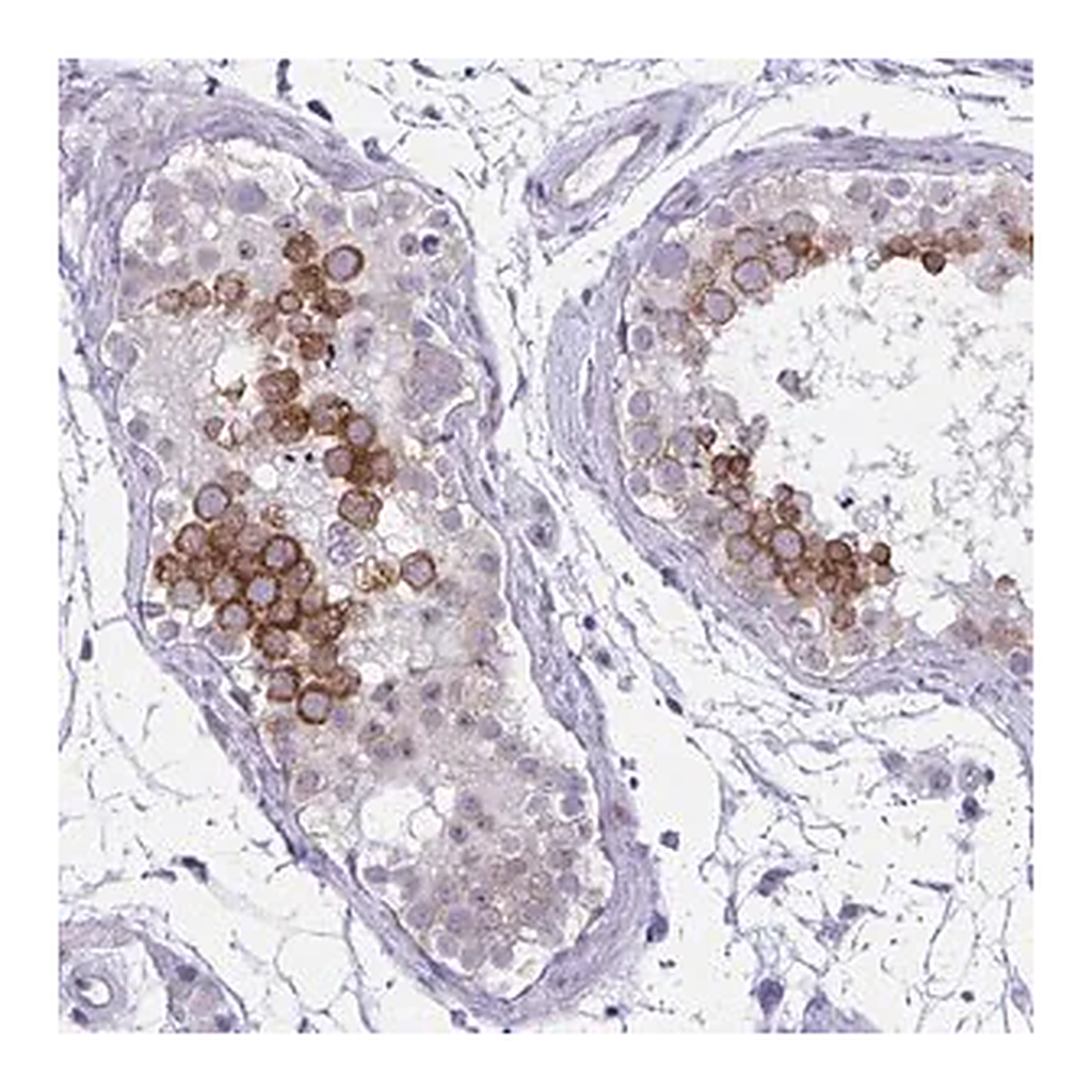 Merck Anti-NFXL1 antibody produced in rabbit
