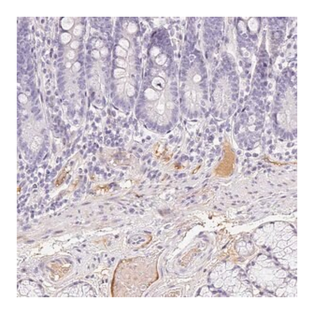 Merck Anti-ITIH2 antibody produced in rabbit