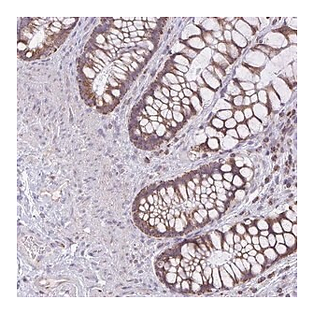 Merck Anti-ZNF362 antibody produced in rabbit