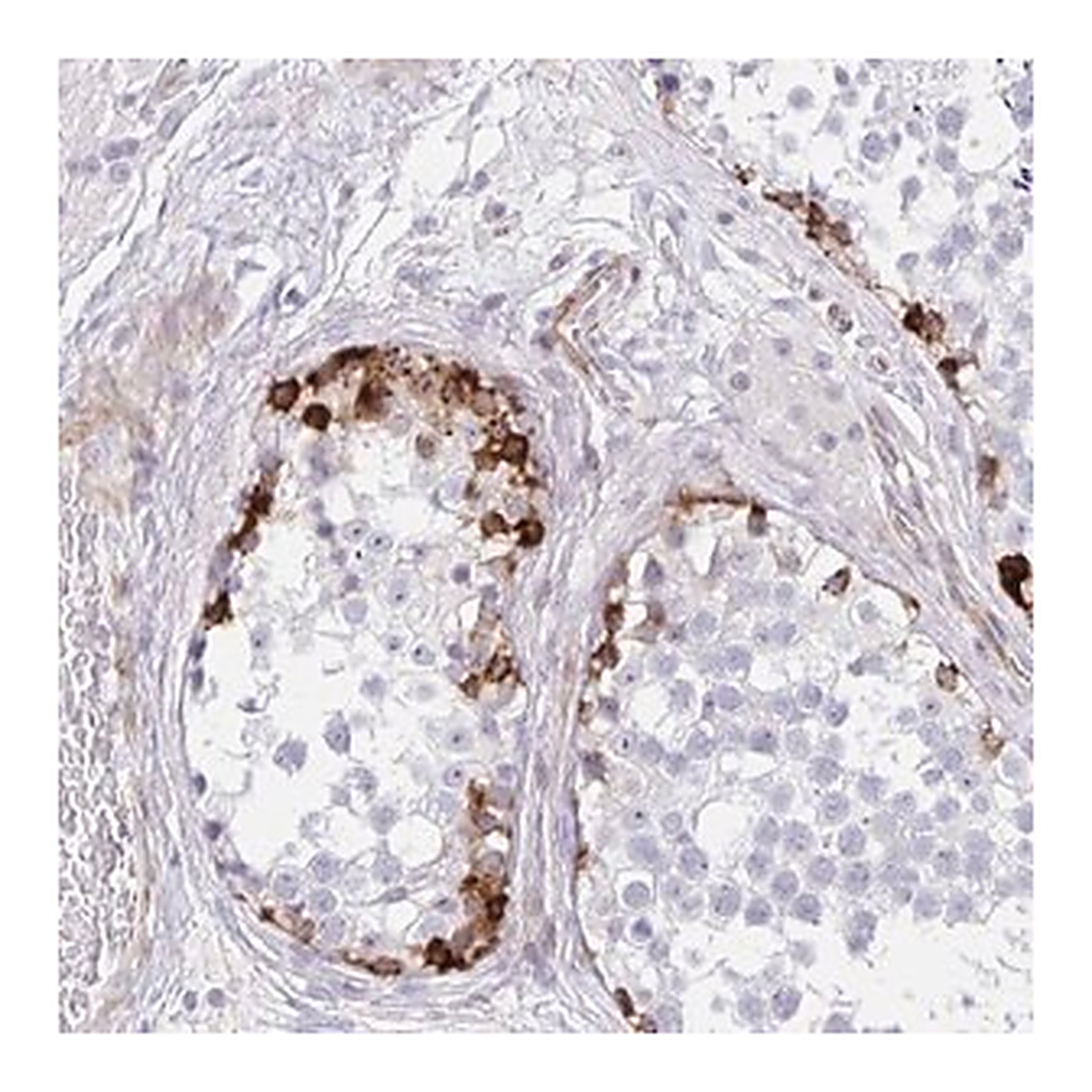 Merck Anti-ZNF713 antibody produced in rabbit