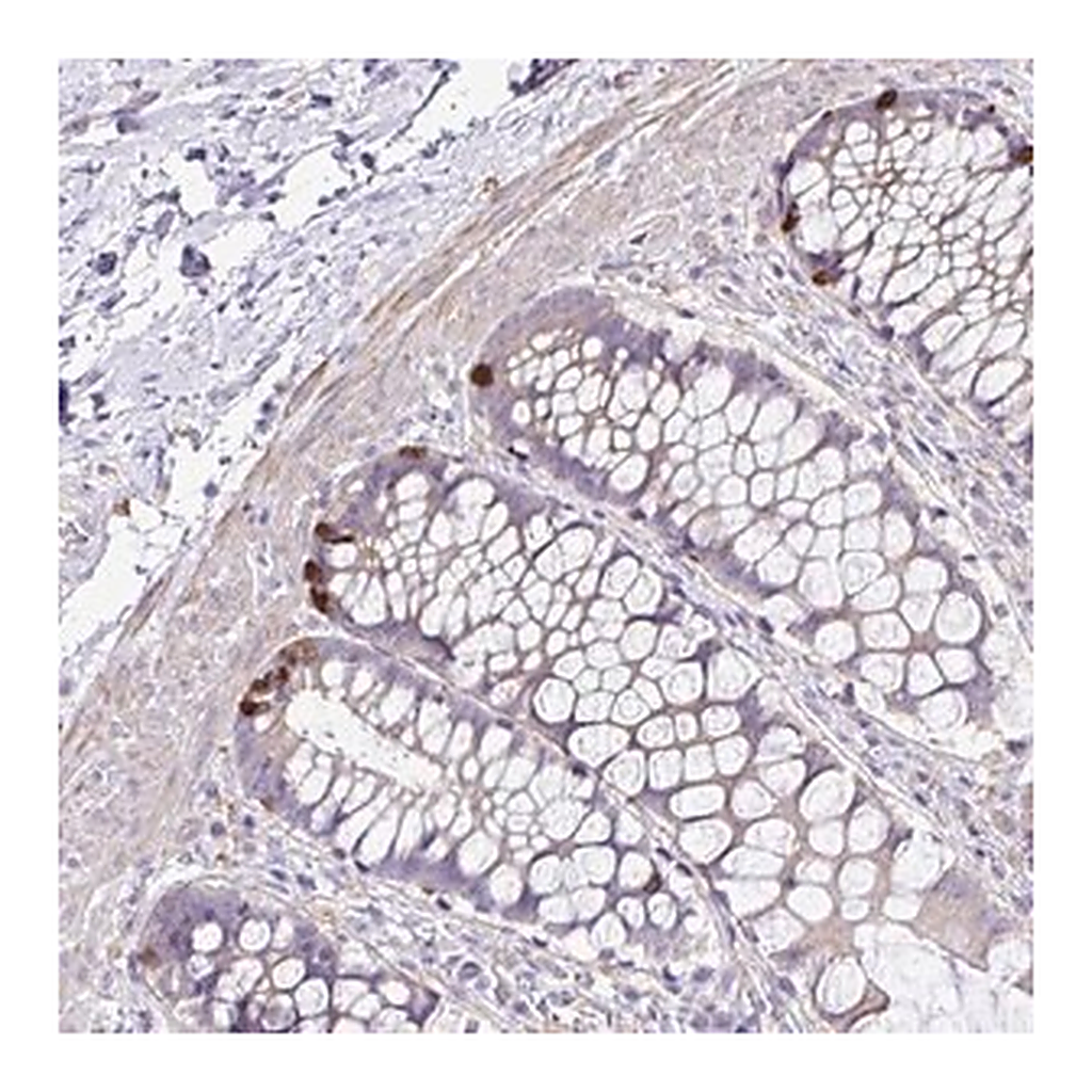 Merck Anti-OR4P4 antibody produced in rabbit