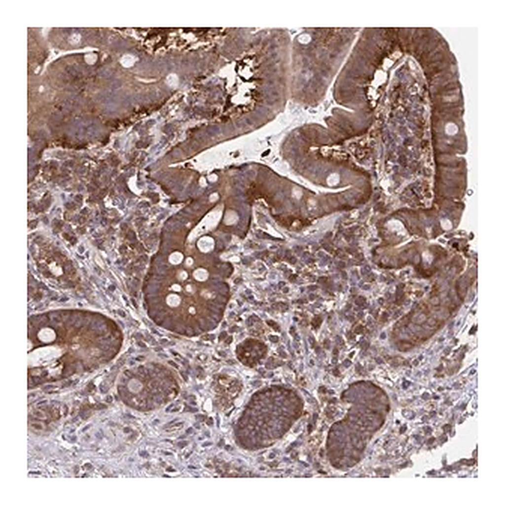 Merck Anti-ALDH16A1 antibody produced in rabbit