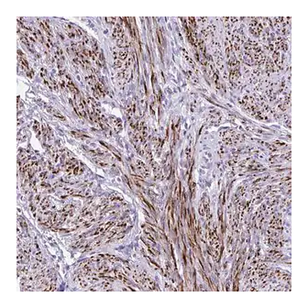 Merck Anti-KCNN4 antibody produced in rabbit