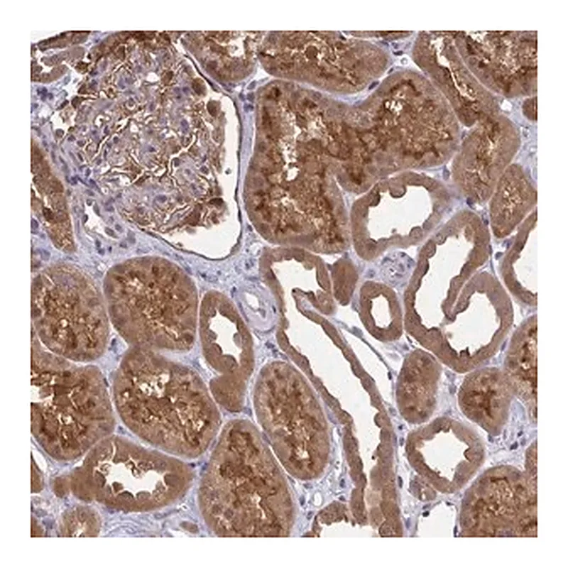 Merck Anti-HDHD2 antibody produced in rabbit