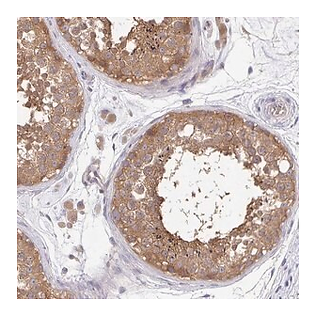 Merck Anti-FEM1C antibody produced in rabbit