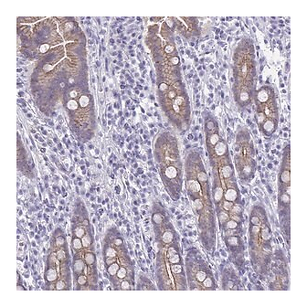 Merck Anti-GLB1L2 antibody produced in rabbit