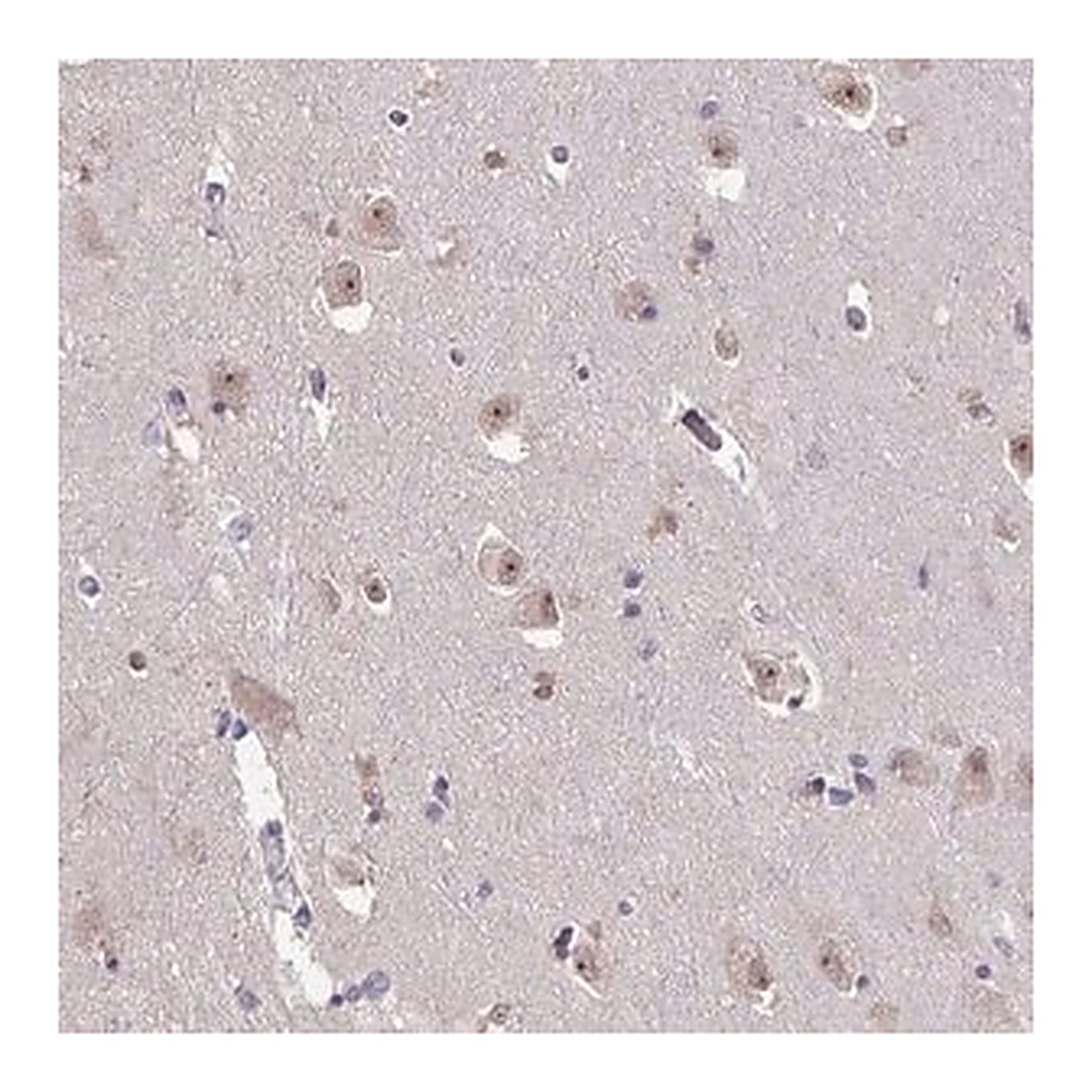 Merck Anti-SENP3 antibody produced in rabbit