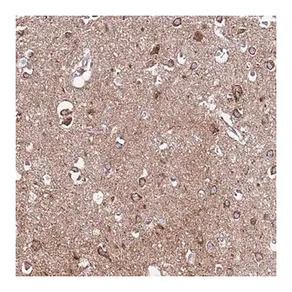 Merck Anti-EVA1B antibody produced in rabbit