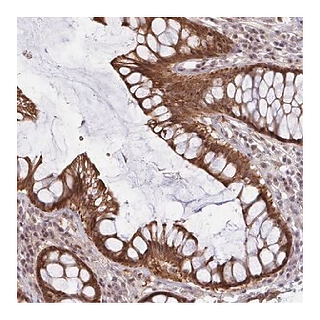 Merck Anti-NLRP13 antibody produced in rabbit