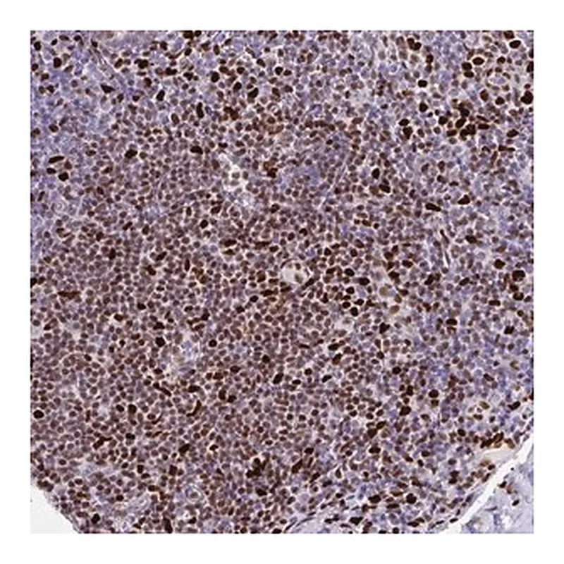 Merck Anti-ZNF586 antibody produced in rabbit