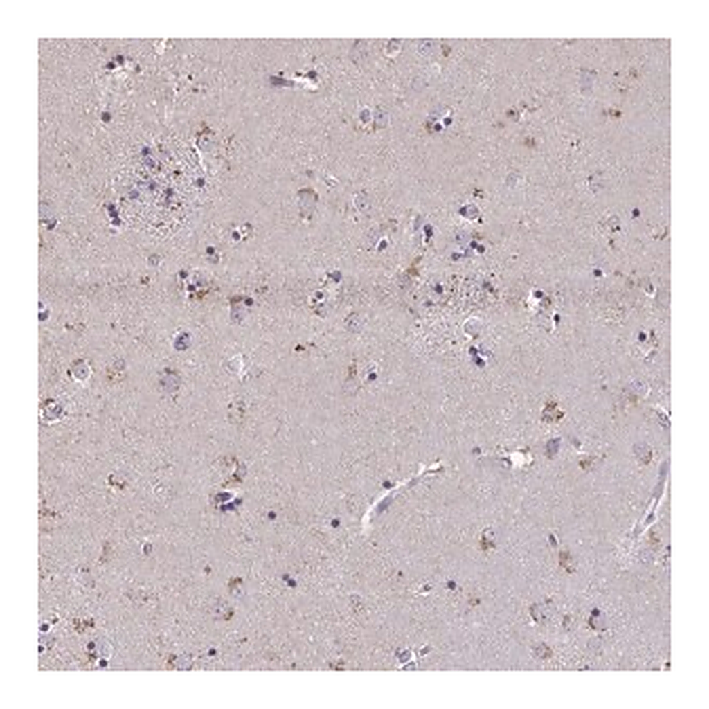 Merck Anti-ZNF34 antibody produced in rabbit