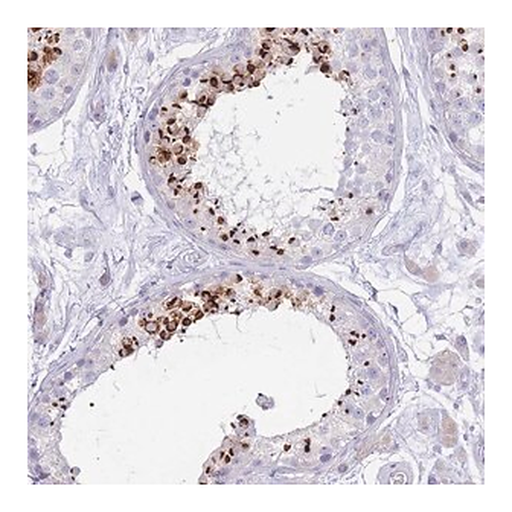 Merck Anti-LRRC37A2 antibody produced in rabbit