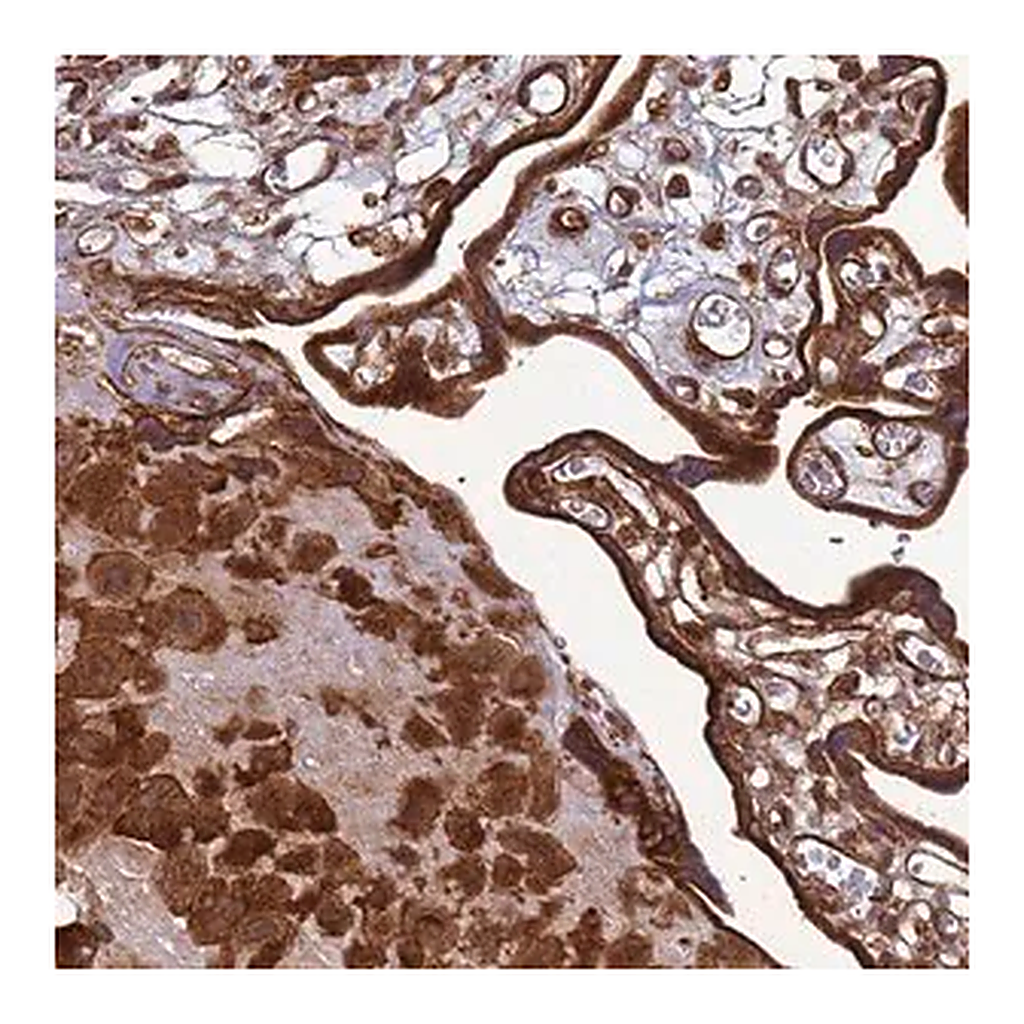 Merck Anti-CNOT1 antibody produced in rabbit