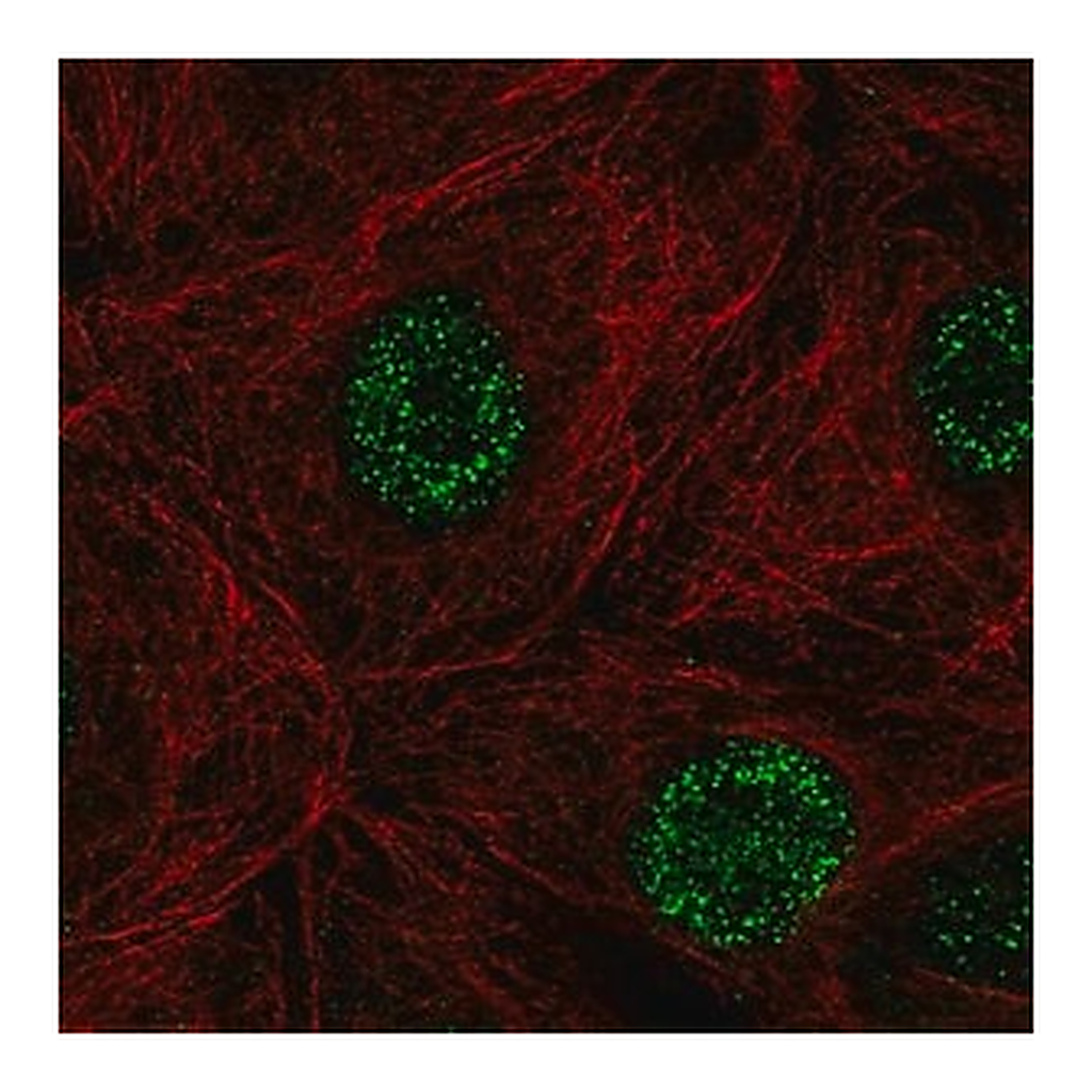 Merck Anti-DCAKD antibody produced in rabbit