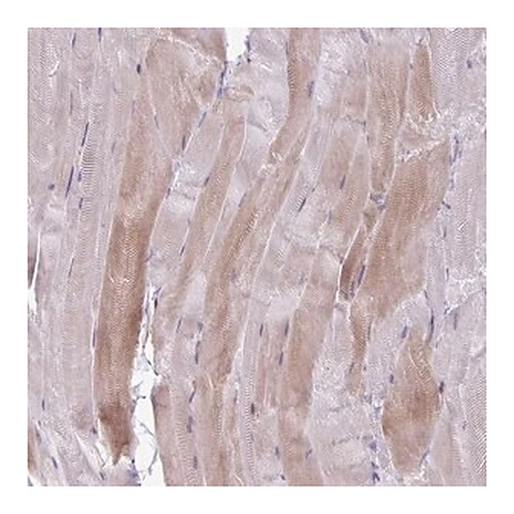 Merck Anti-PPP1R3E antibody produced in rabbit