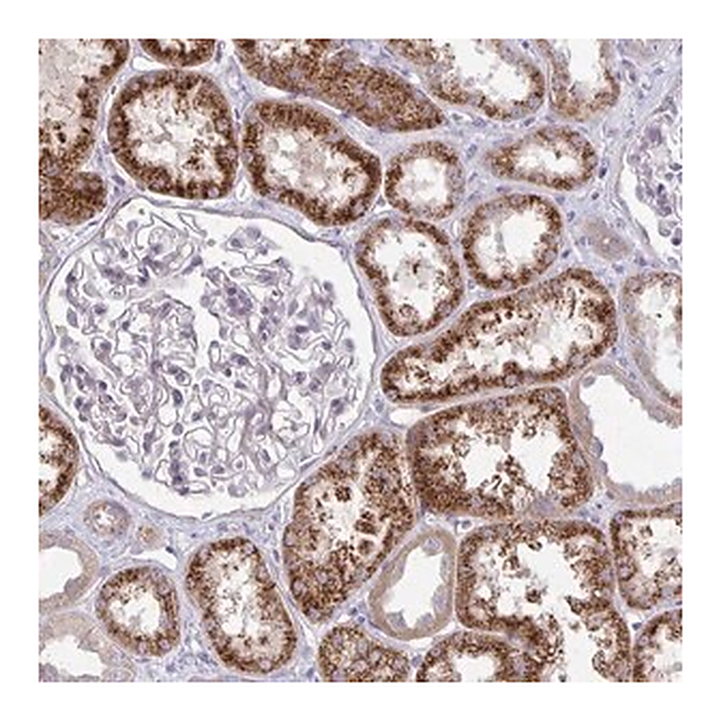 Merck Anti-KATNBL1 antibody produced in rabbit