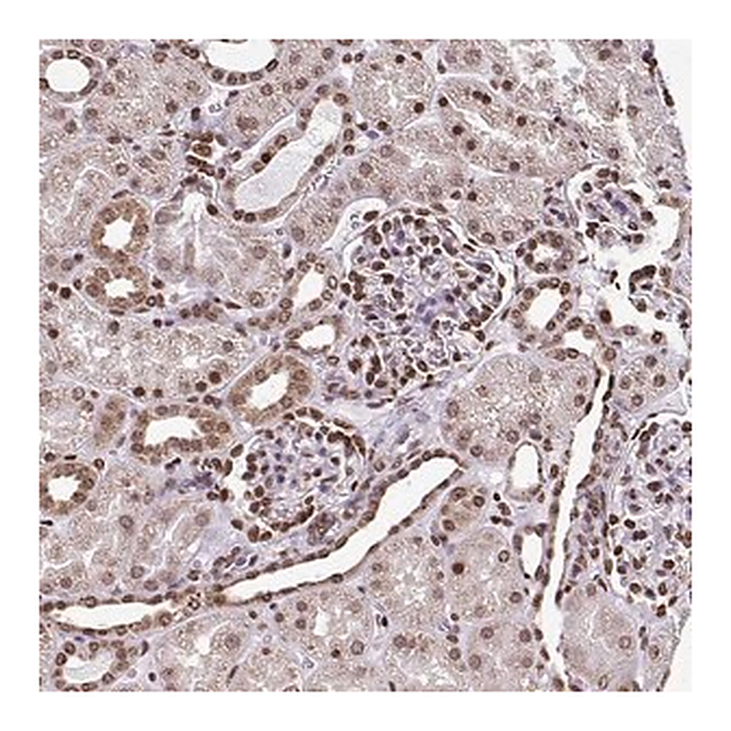 Merck Anti-HOXA9 antibody produced in rabbit