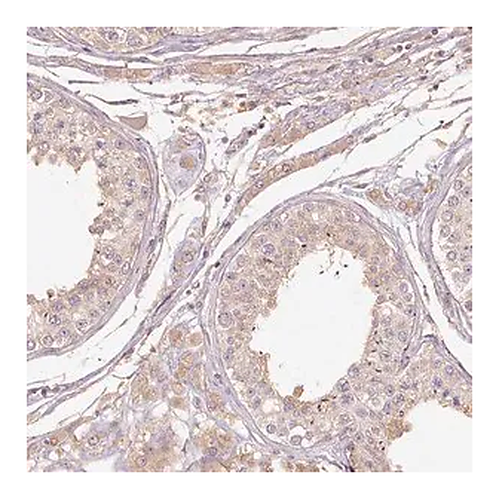 Merck Anti-RB1CC1 antibody produced in rabbit