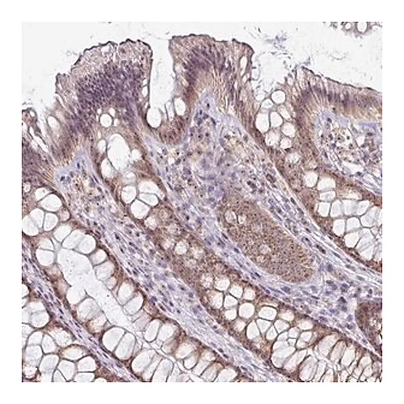 Merck Anti-NACC2 antibody produced in rabbit