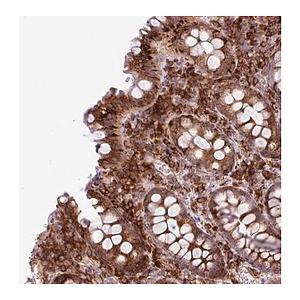 Merck Anti-CFAP97 antibody produced in rabbit
