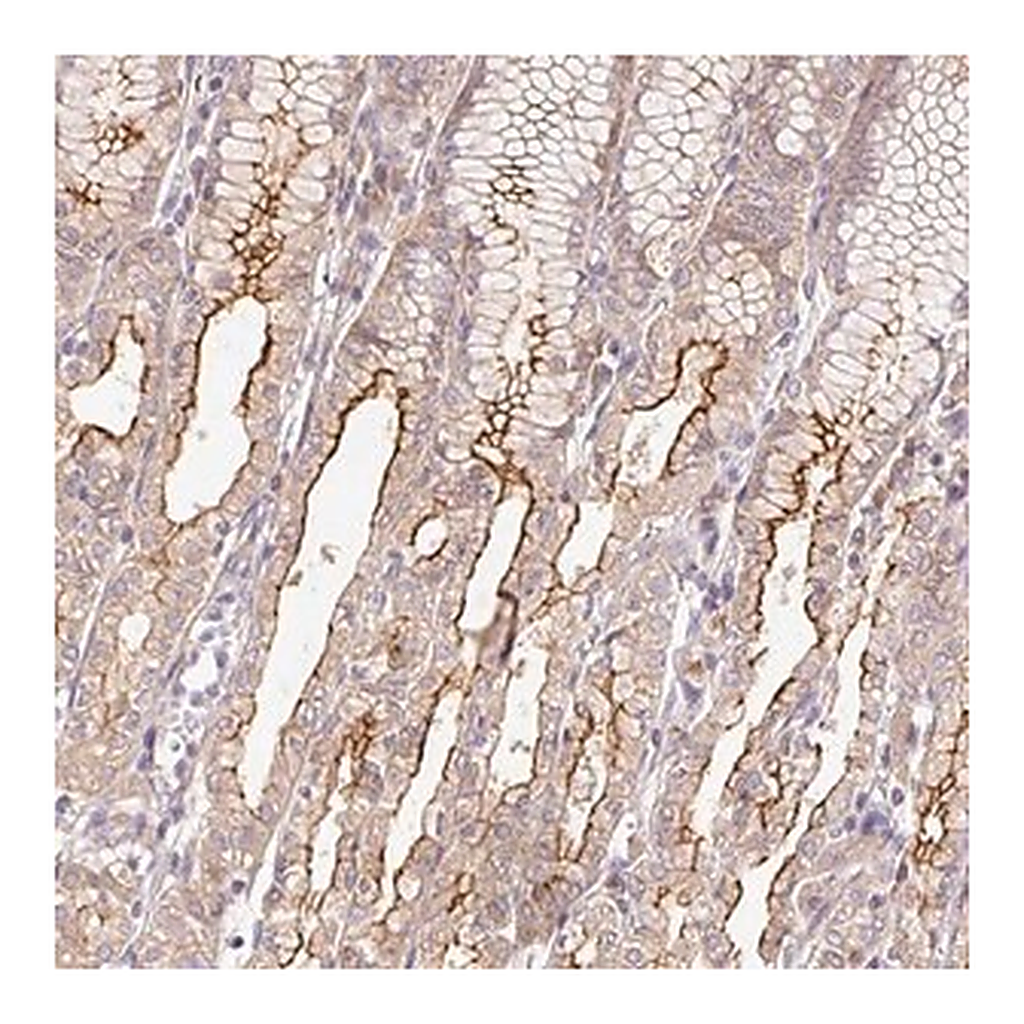Merck Anti-DESI1 antibody produced in rabbit