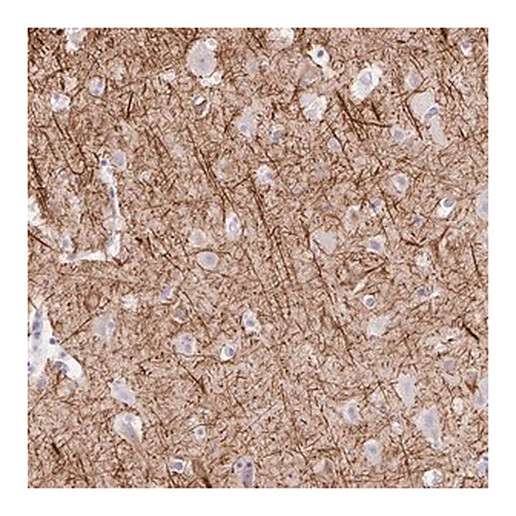 Merck Anti-EMC4 antibody produced in rabbit