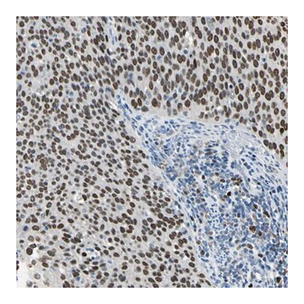 Merck Anti-ZKSCAN3 antibody produced in rabbit