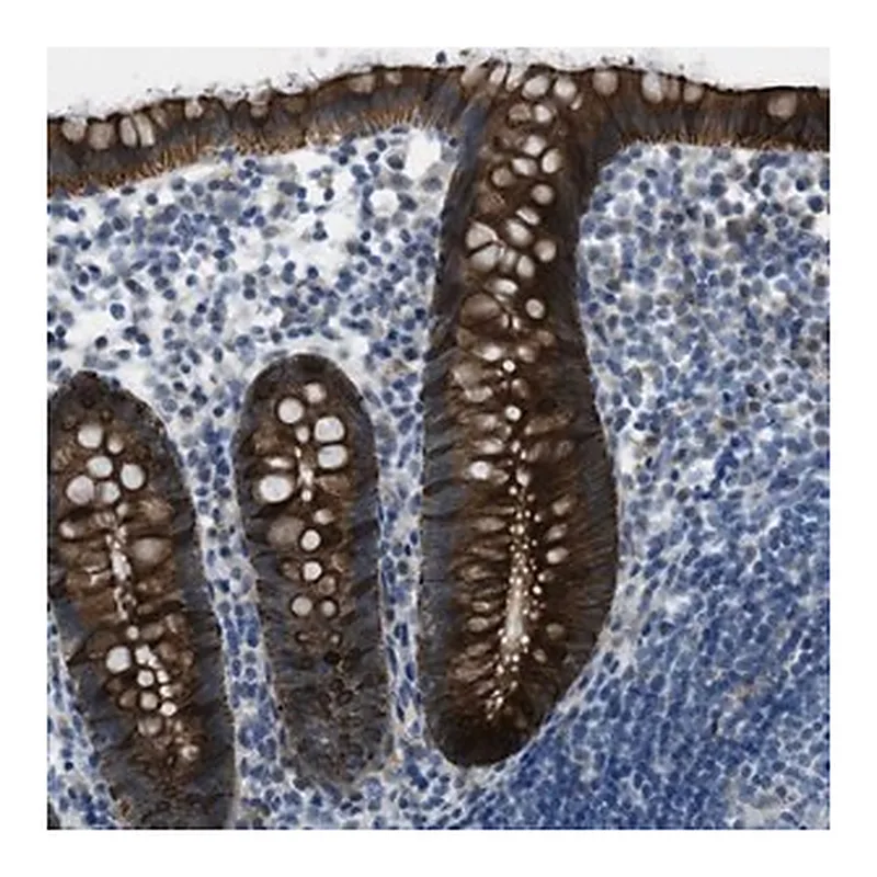 Merck Anti-KLHL8 antibody produced in rabbit