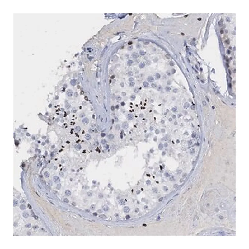 Merck Anti-CBX2 antibody produced in rabbit