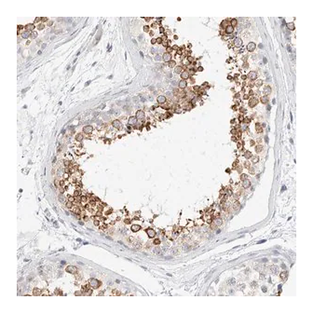 Merck Anti-RTN4 antibody produced in rabbit
