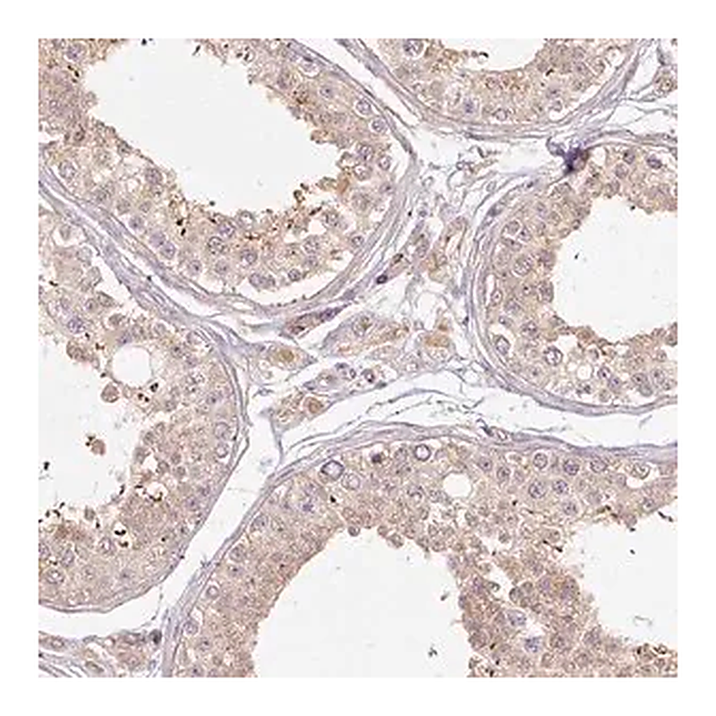 Merck Anti-RB1CC1 antibody produced in rabbit