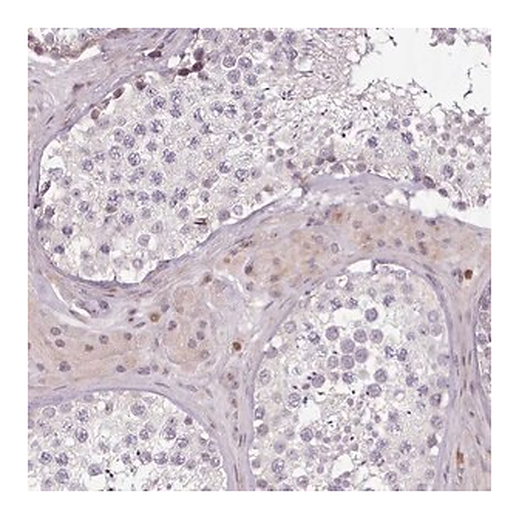 Merck Anti-ZNF583 antibody produced in rabbit