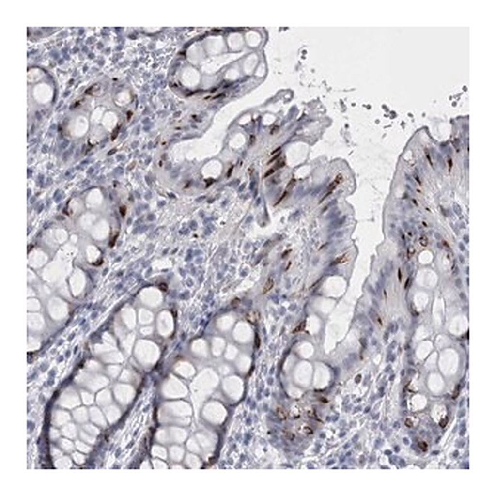 Merck Anti-VWDE antibody produced in rabbit