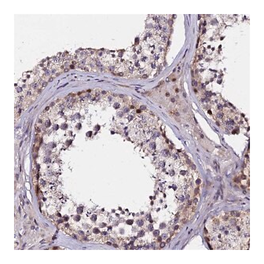 Merck Anti-GPN3 antibody produced in rabbit