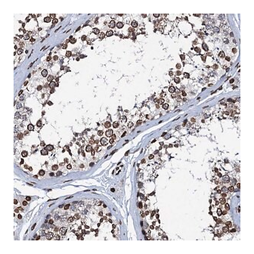 Merck Anti-KATNAL2 antibody produced in rabbit