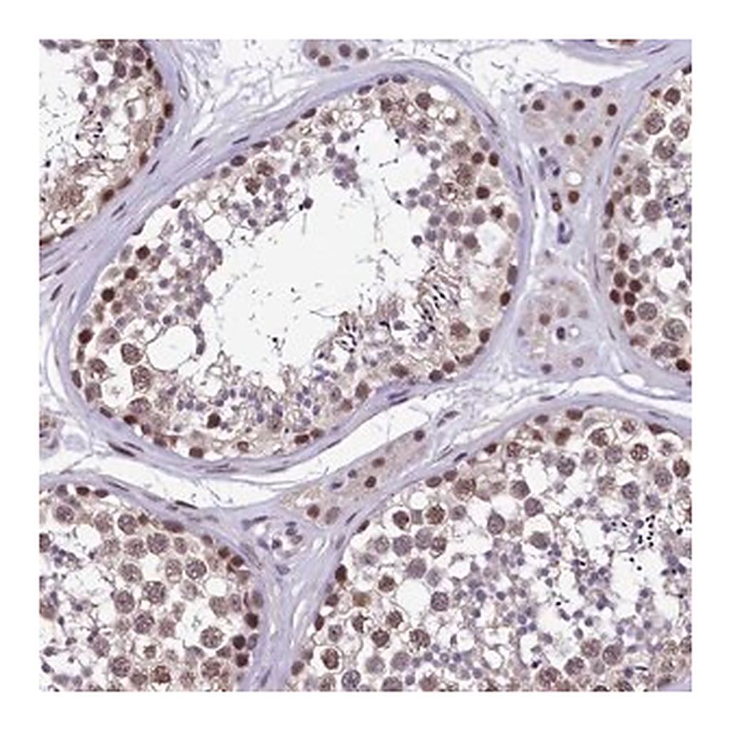 Merck Anti-HECTD4 antibody produced in rabbit