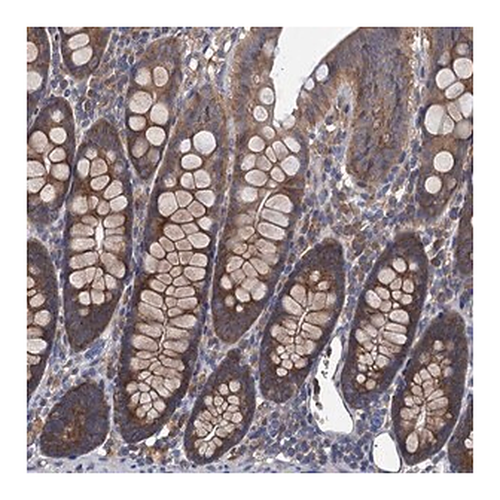 Merck Anti-ADCY9 antibody produced in rabbit