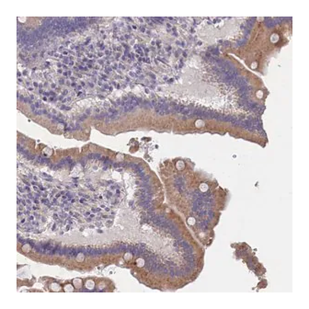 Merck Anti-CYP2U1 antibody produced in rabbit