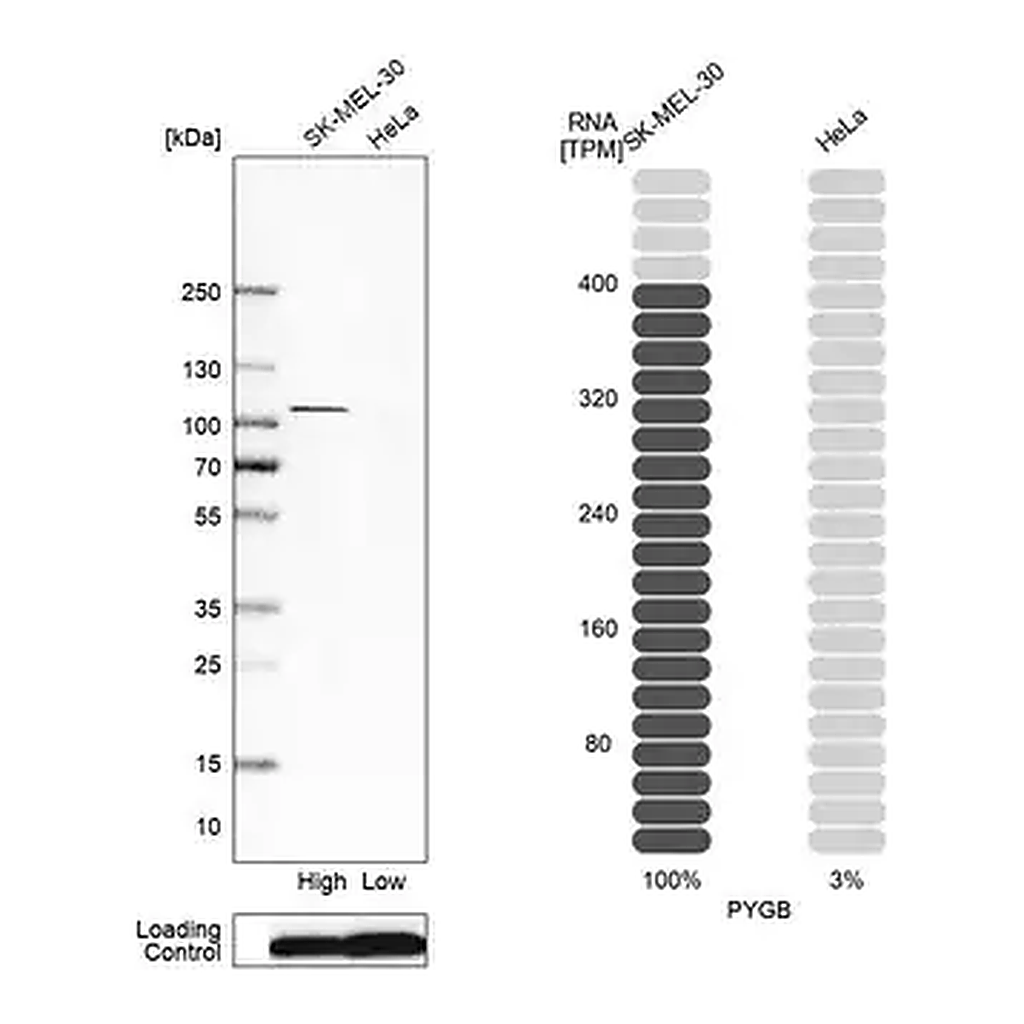 Merck Anti-PYGB antibody produced in rabbit