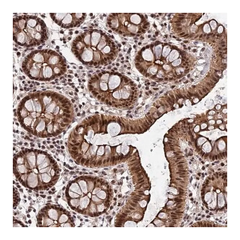 Merck Anti-ERCC5 antibody produced in rabbit