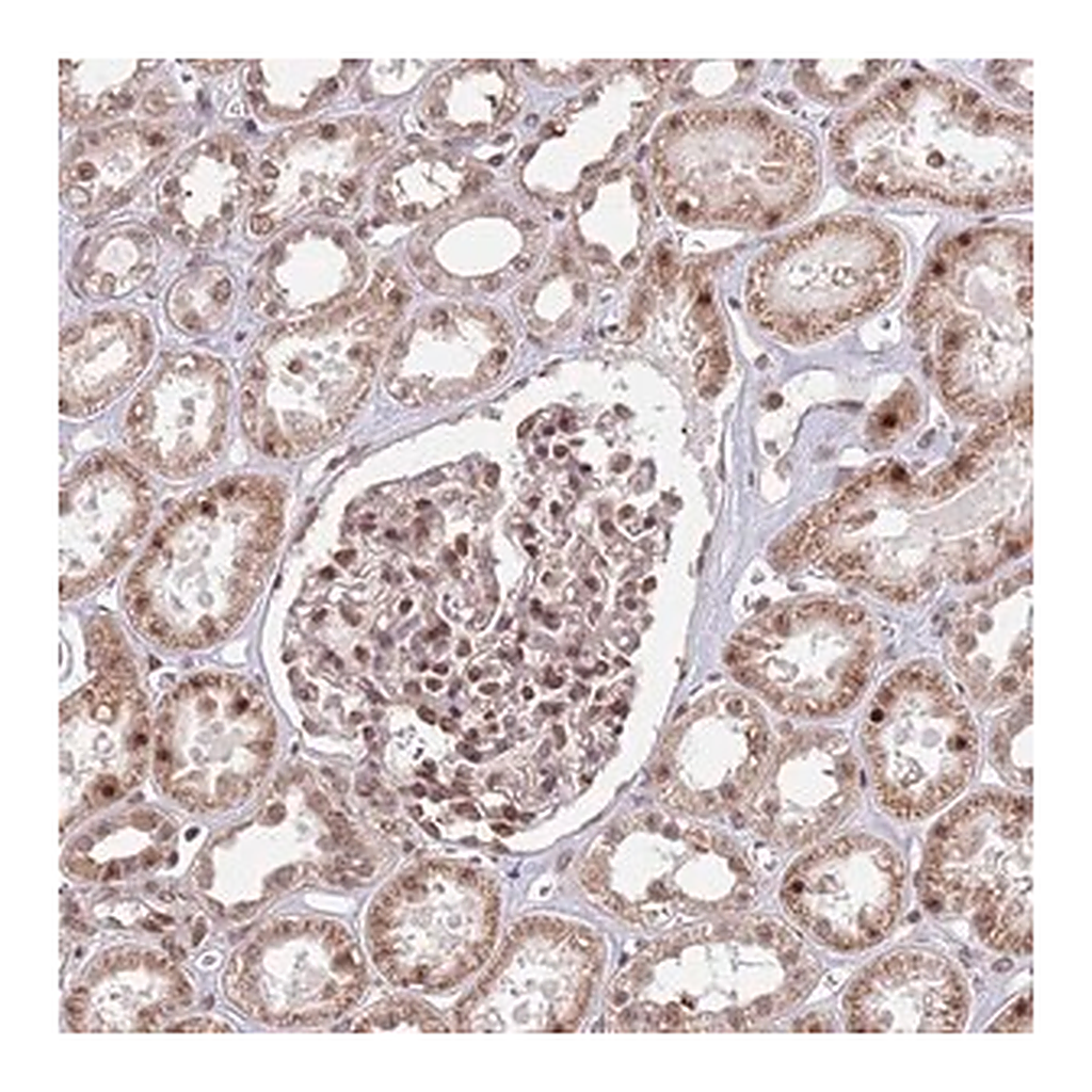 Merck Anti-SIPA1L3 antibody produced in rabbit