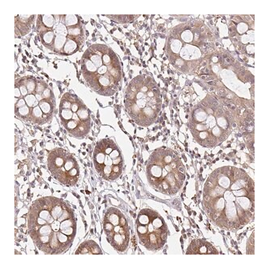 Merck Anti-LARS2 antibody produced in rabbit