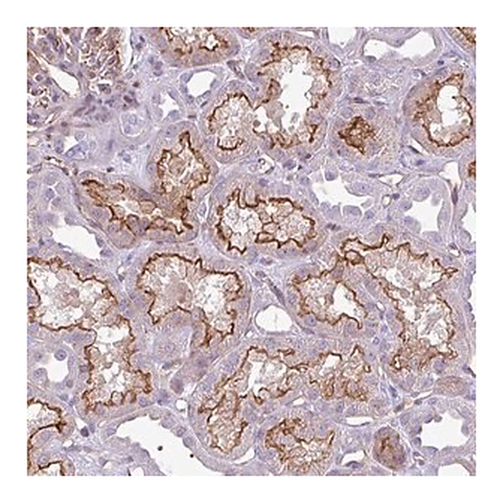 Merck Anti-EME2 antibody produced in rabbit
