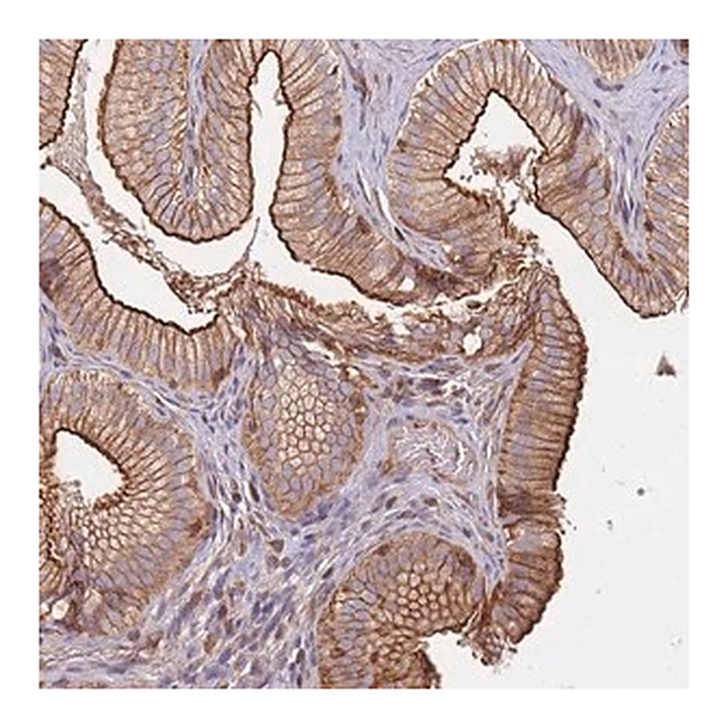 Merck Anti-CYP2U1 antibody produced in rabbit