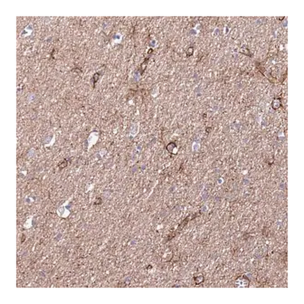 Merck Anti-JAKMIP2 antibody produced in rabbit